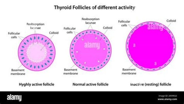 How many follicles is considered hyperstimulation