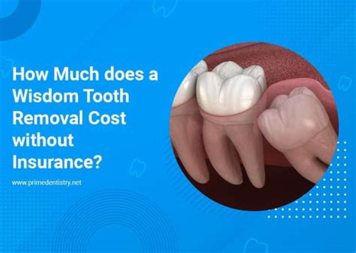 How much does wisdom panel cost