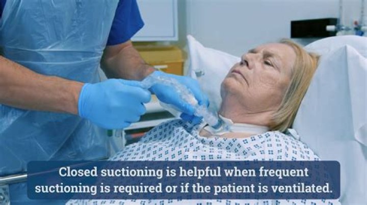 How often should you suction a patient