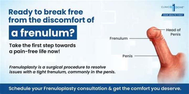 Is a Frenulum normal