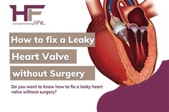 Is a heart murmur the same as a leaky valve