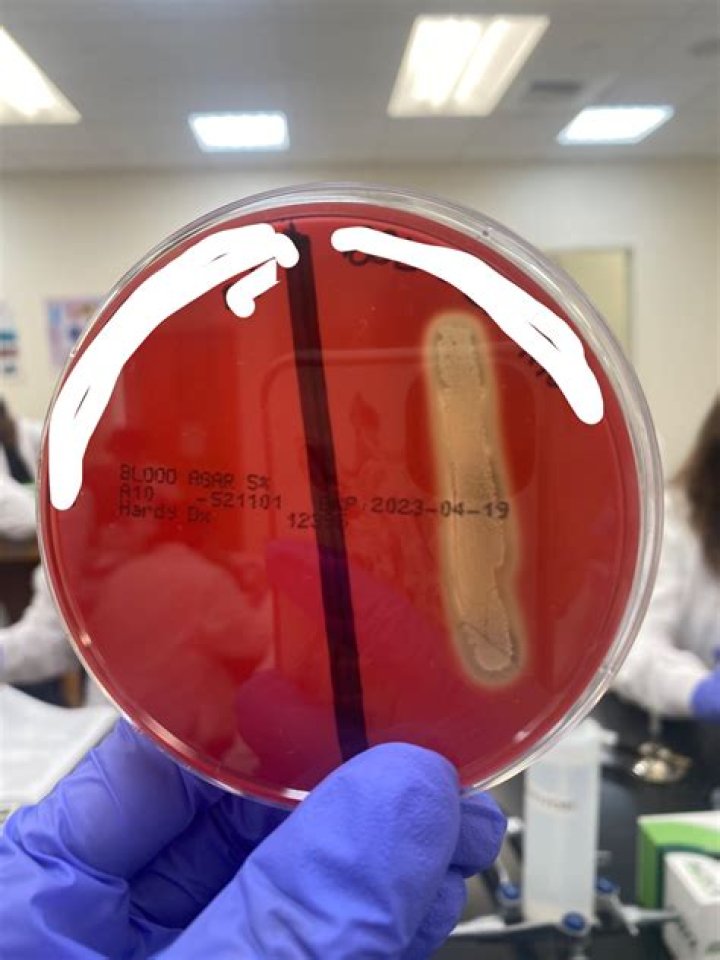 Is Alcaligenes faecalis Neutrophile