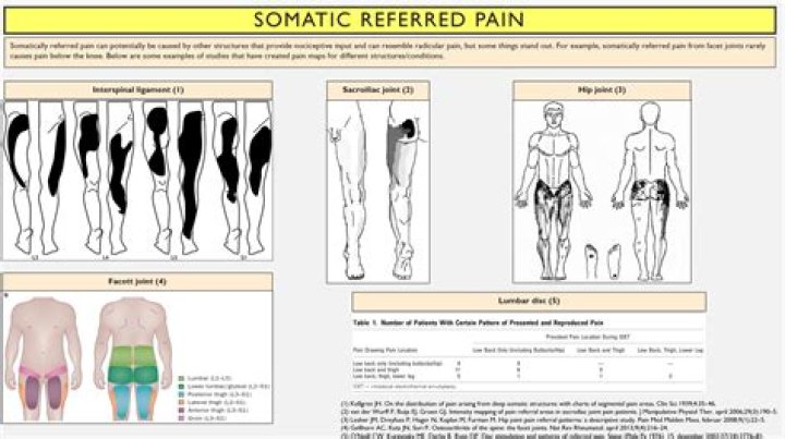 Is arthritis somatic pain