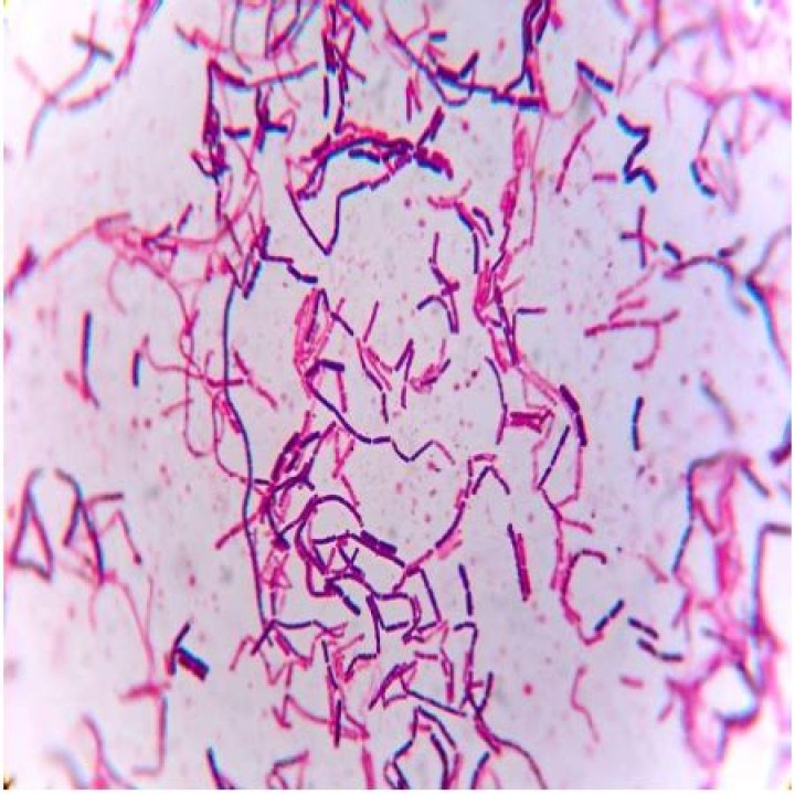 Is B cereus Gram positive or negative