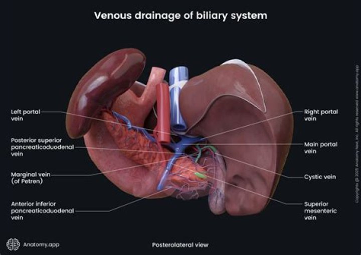 Is biliary drainage permanent