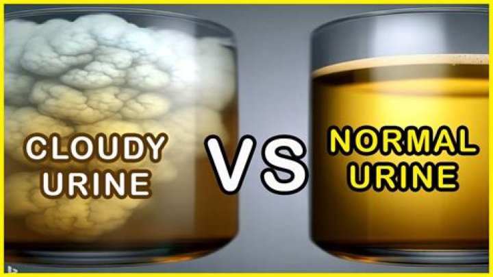 Is cloudy pee normal