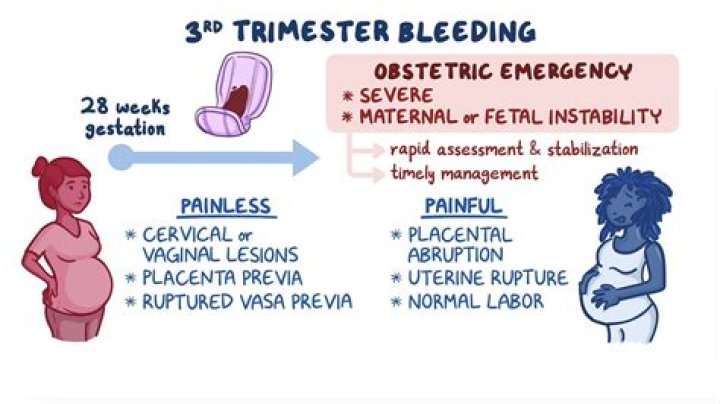 Is Dancing safe in third trimester