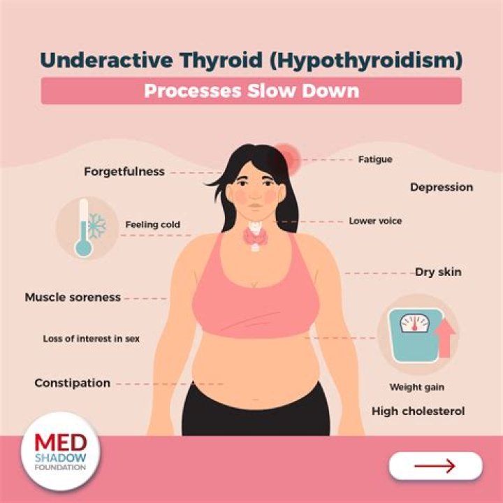 Is hypothyroidism common in the elderly