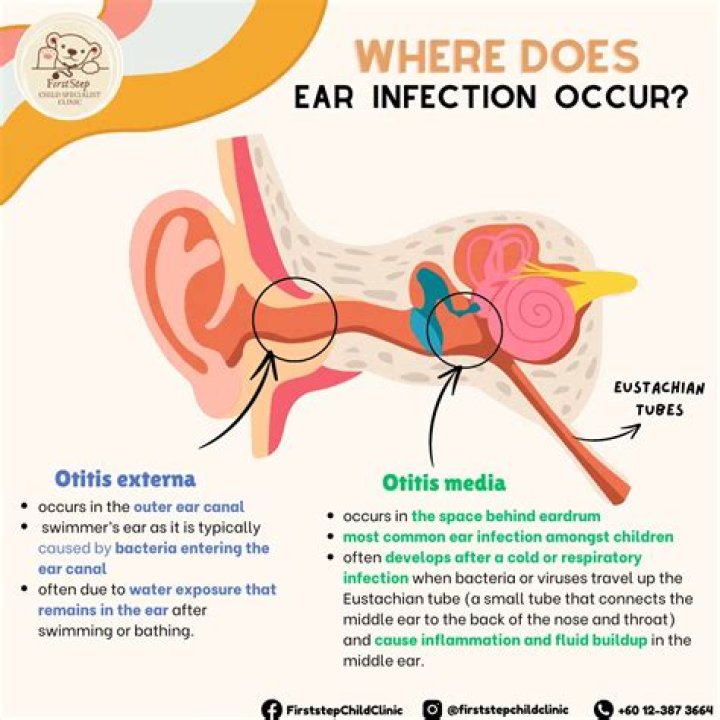 Is it OK to take a baby out with an ear infection