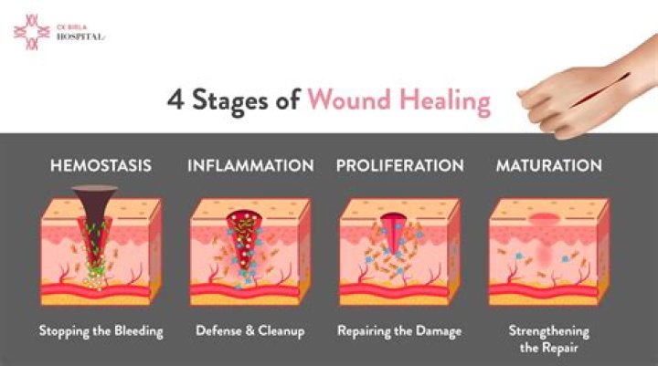 Is my cut healing or infected