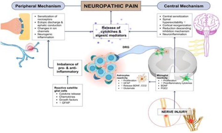Is neurogenic pain the same as neuropathic