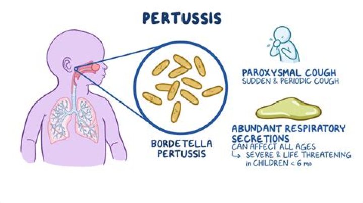 Is pertussis droplet or airborne