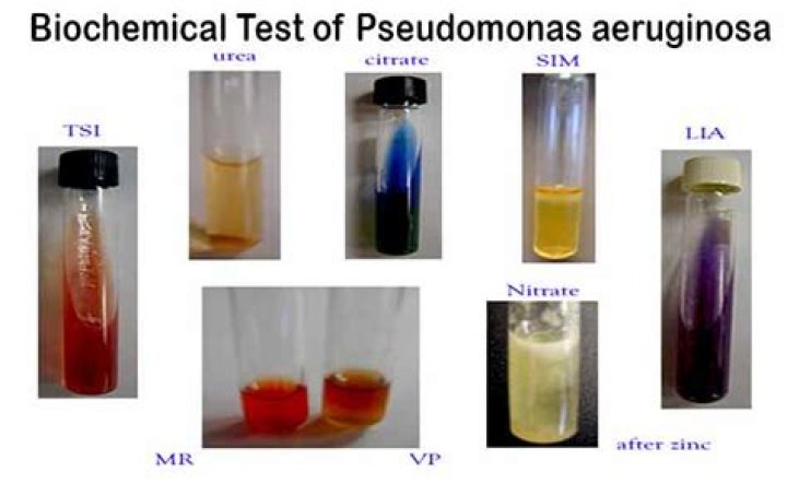 Is Pseudomonas citrate positive or negative