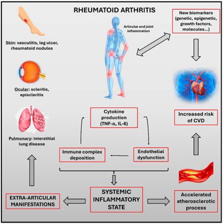 Is rheumatoid arthritis inflammatory