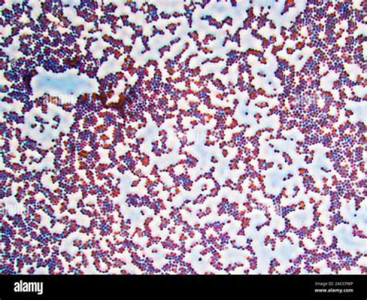 Is Staphylococcus aureus aerobic or anaerobic