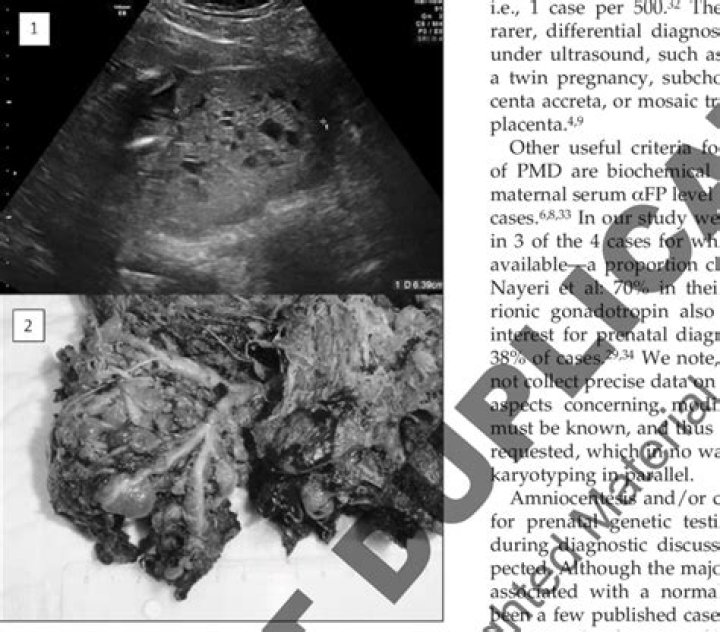 Is thick placenta normal