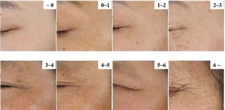 What age do crows feet appear