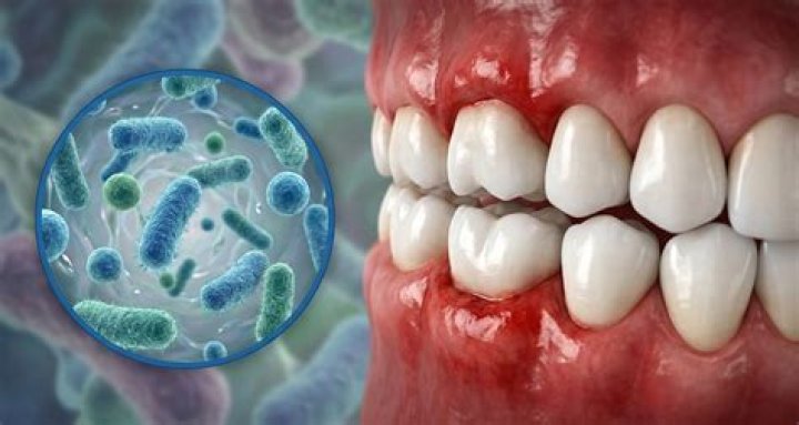 What are oral pathogens