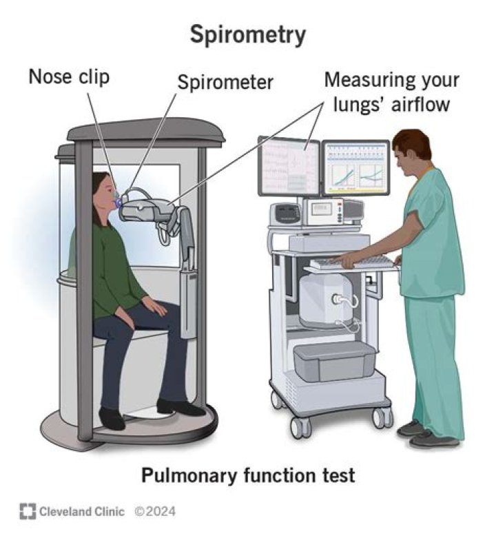 What are the 4 volumes seen on a spirometer