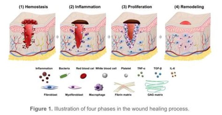 What are the factors you need to consider when coding for wound repair