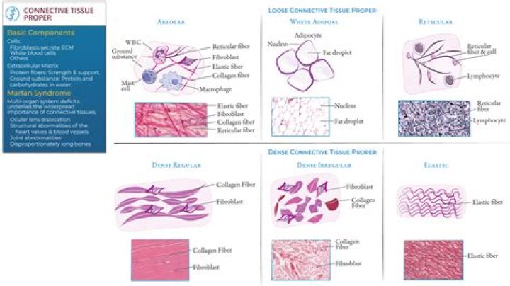 What are the major categories of connective tissue