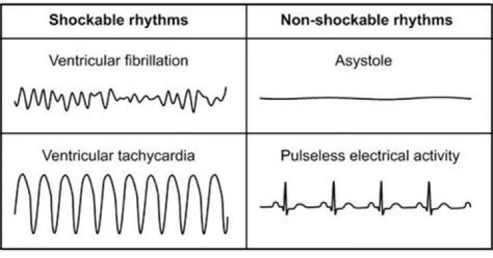 What are the shockable rhythms an AED recognizes