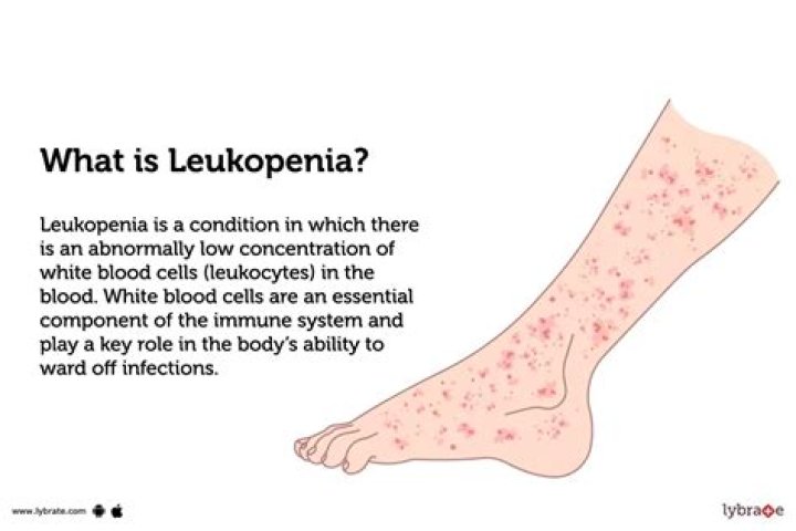 What are the signs and symptoms of leukopenia