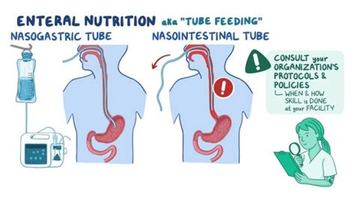 What are the signs of intolerance to a tube feeding