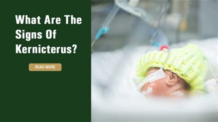 What are the signs of kernicterus