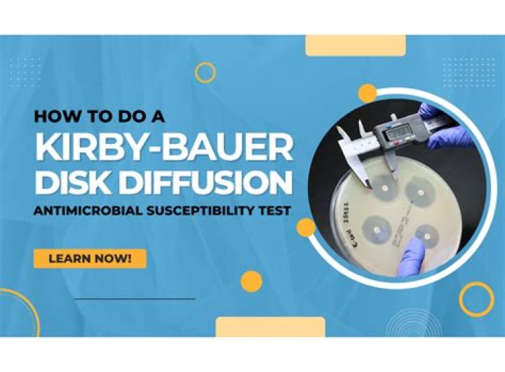 What are the steps of the Kirby Bauer method