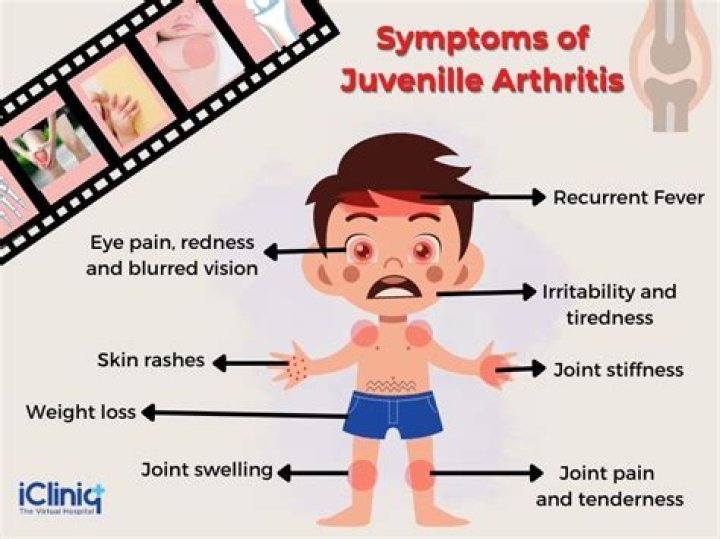 What are the symptoms of juvenile rheumatoid arthritis