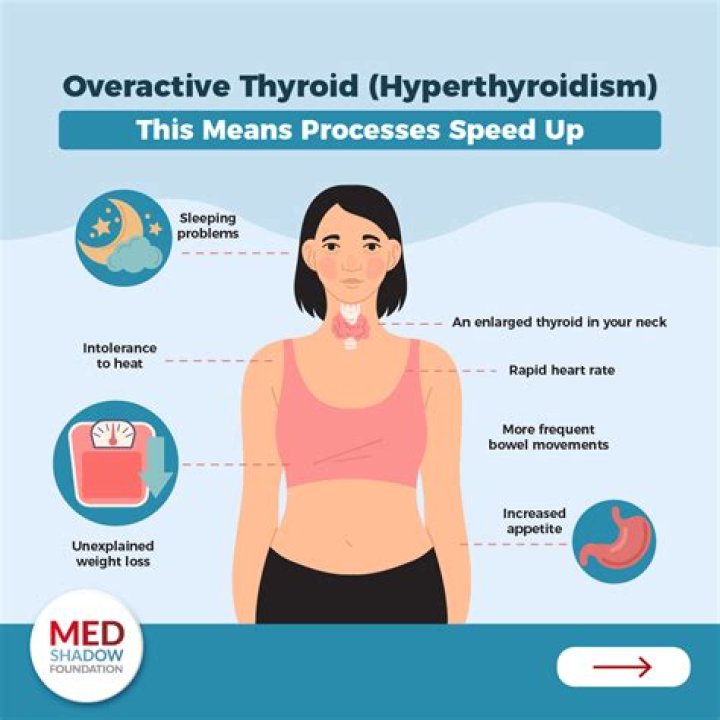 What are the symptoms of levothyroxine overdose