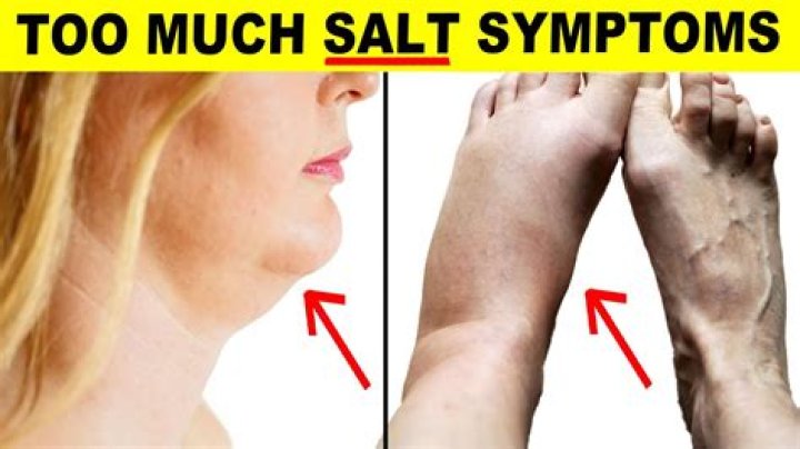 What are the symptoms of too much sodium