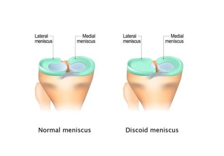What attaches to the medial meniscus