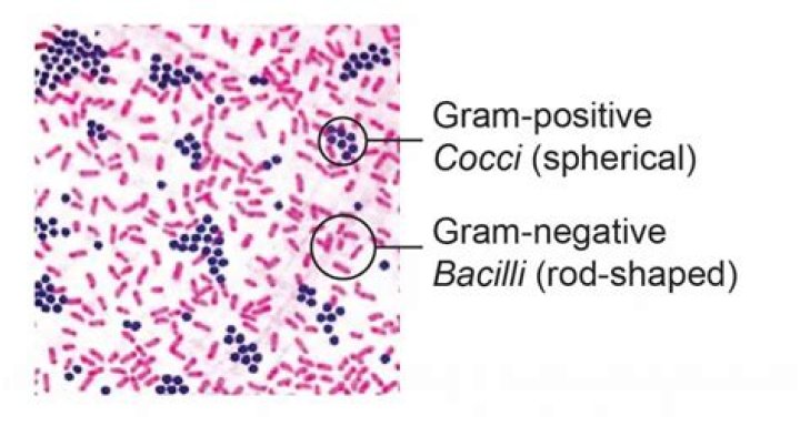 What bacteria Cannot be Gram stained