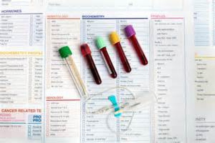 What blood test should be done yearly