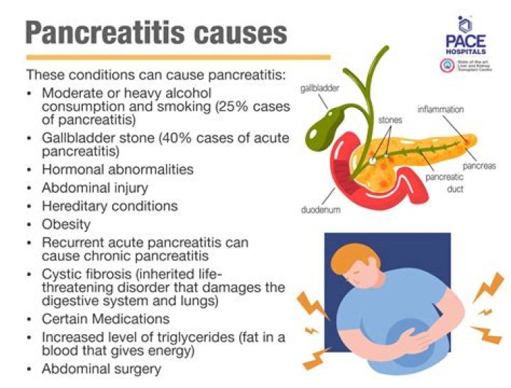 What can cause a flare up of pancreatitis