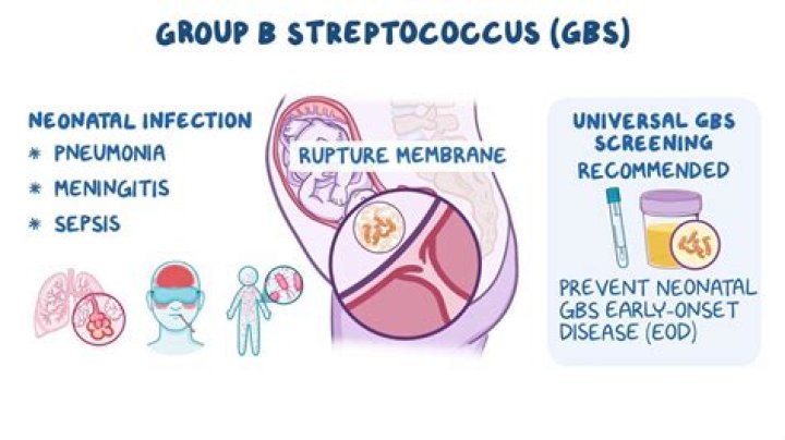 What Can Group B Strep do to a baby
