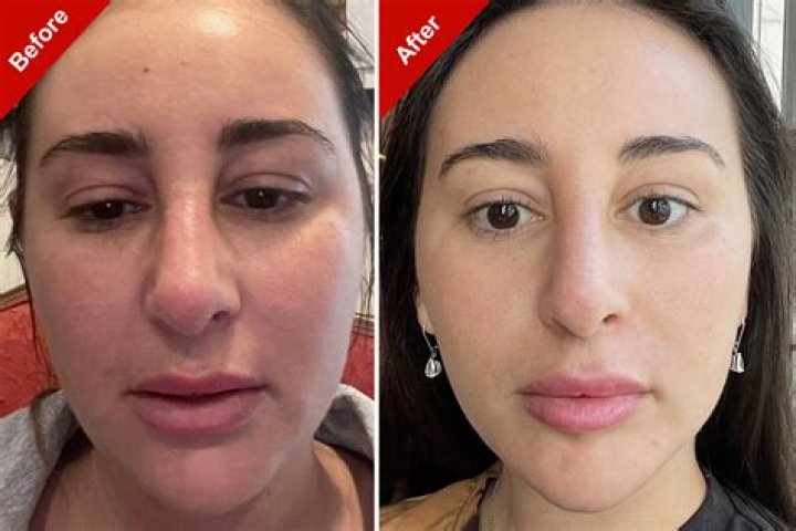 What can I use to absorb oil on my face