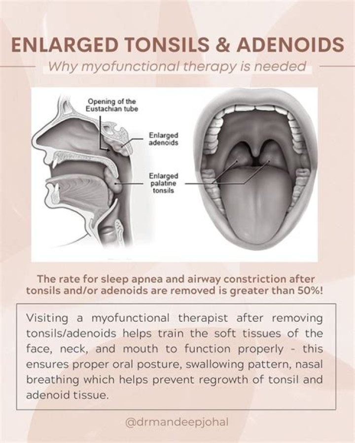 What causes adenoids to swell