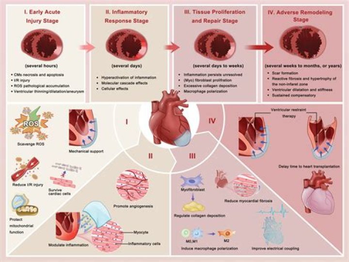 What causes cardiac remodeling