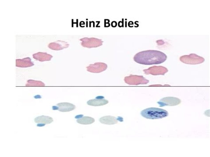 What causes Heinz bodies in cats