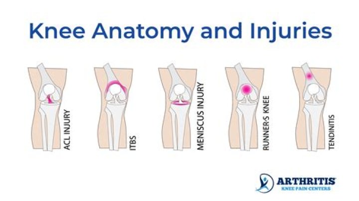 What causes knee jerk reaction