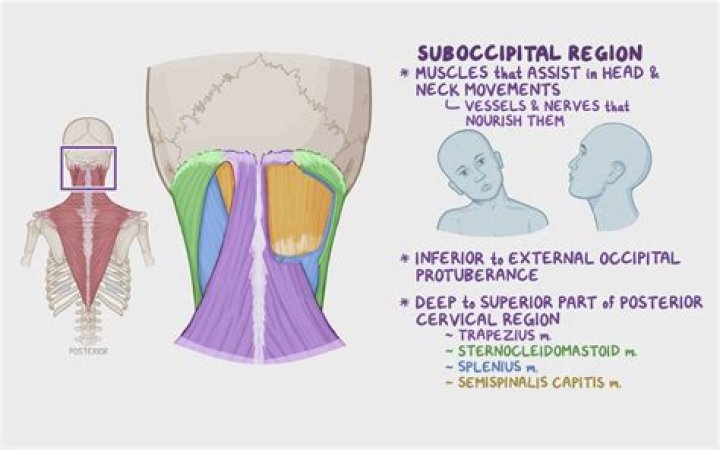 What causes nuchal pain