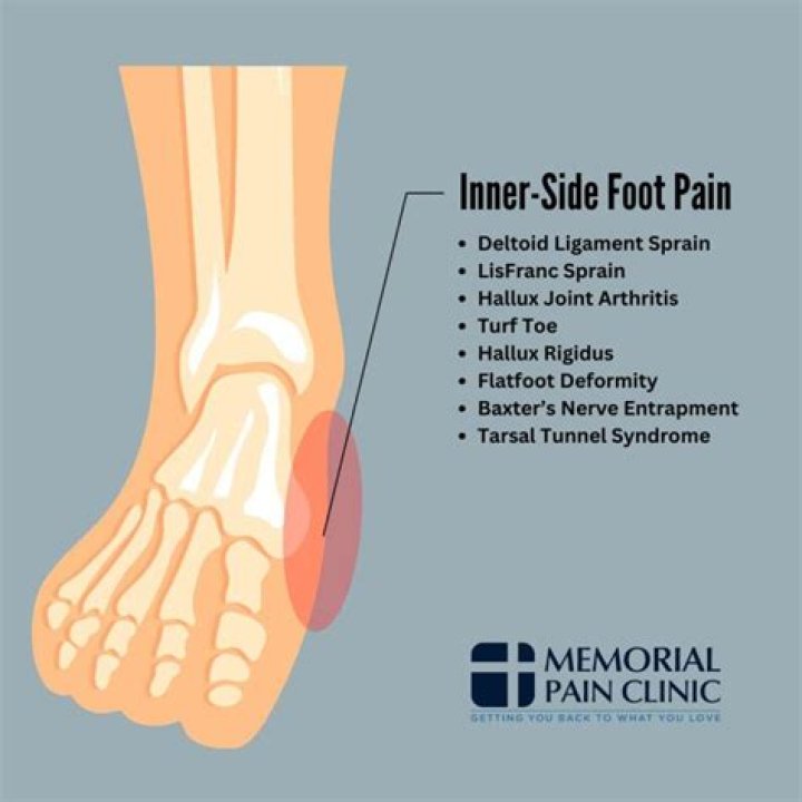 What causes pain on the inner side of the foot