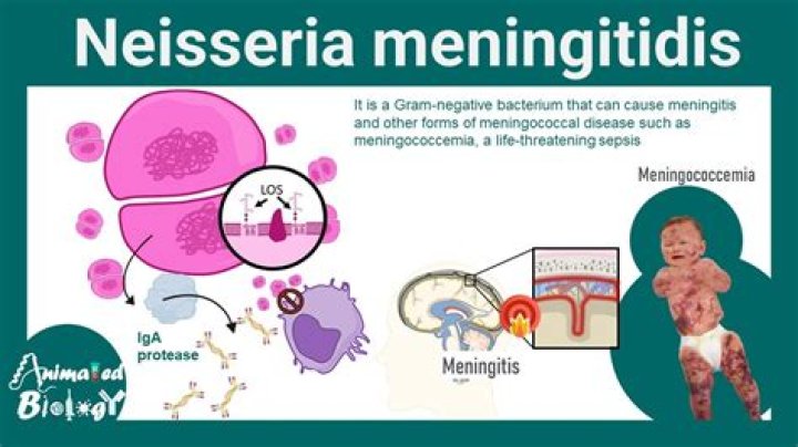 What disease is caused by Neisseria