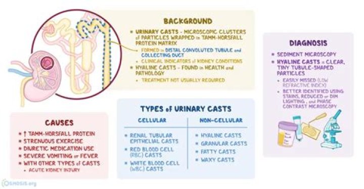 What do hyaline casts in urine indicate