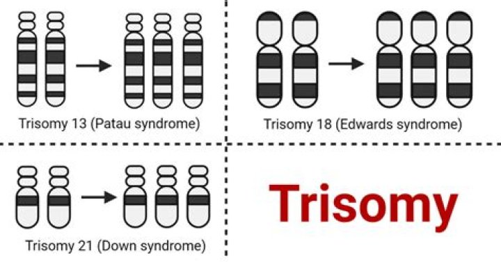 What do you mean by Trisomy 21