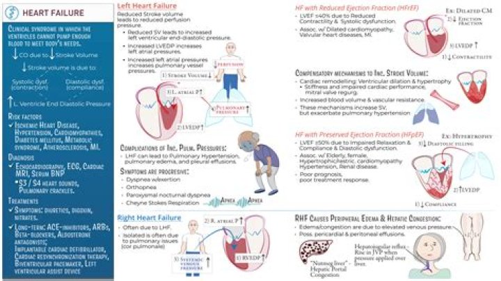 What does a nurse expect that a client with right sided heart failure will exhibit