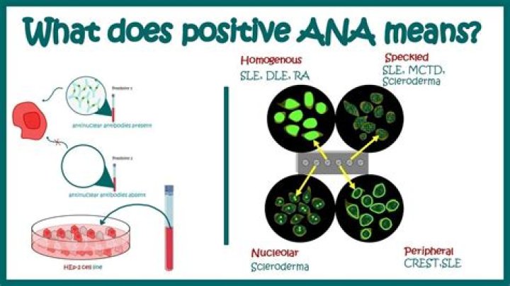 What does a positive AFN mean